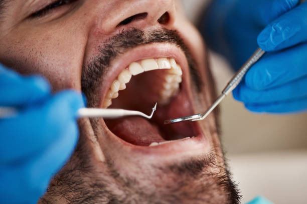 Best Emergency Root Canal Treatment in Violet, LA