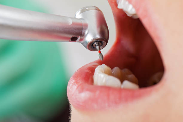 Best Cosmetic Emergency Dentistry in Violet, LA